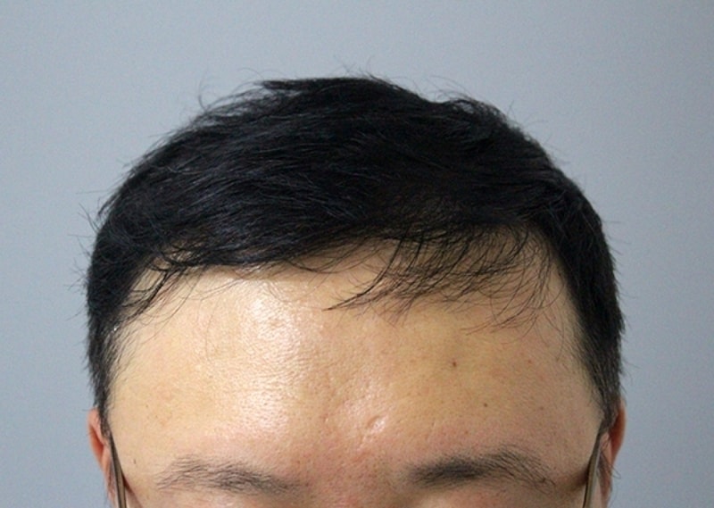 수술후1.jpg