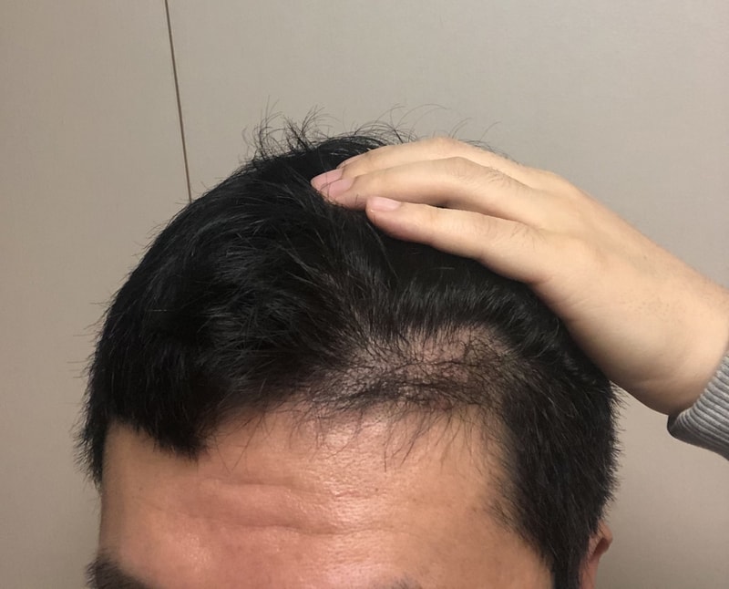 4개월차 후기