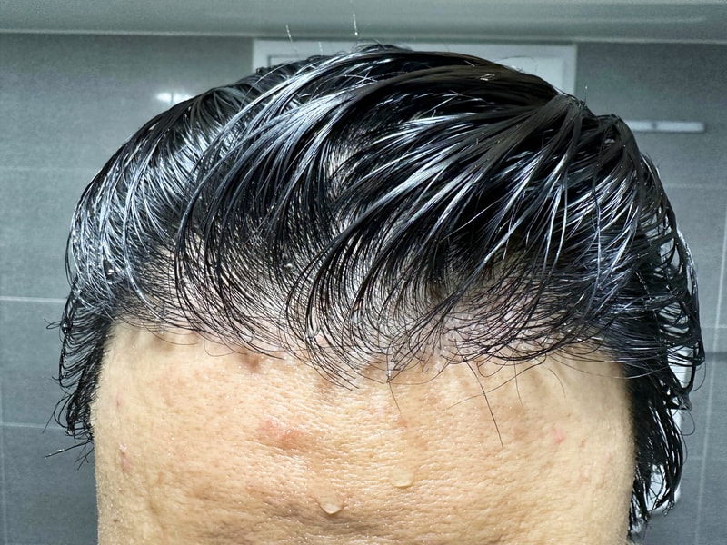 리터치 5개월 후기입니다