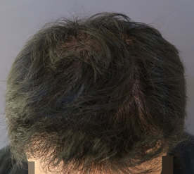 1년후1.jpg