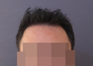 1년후2.jpg