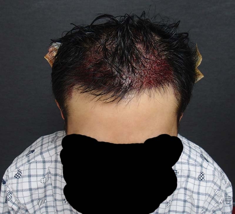 수술1.jpg
