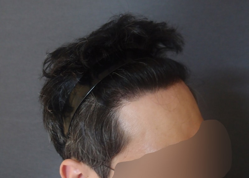 수술후2.jpg