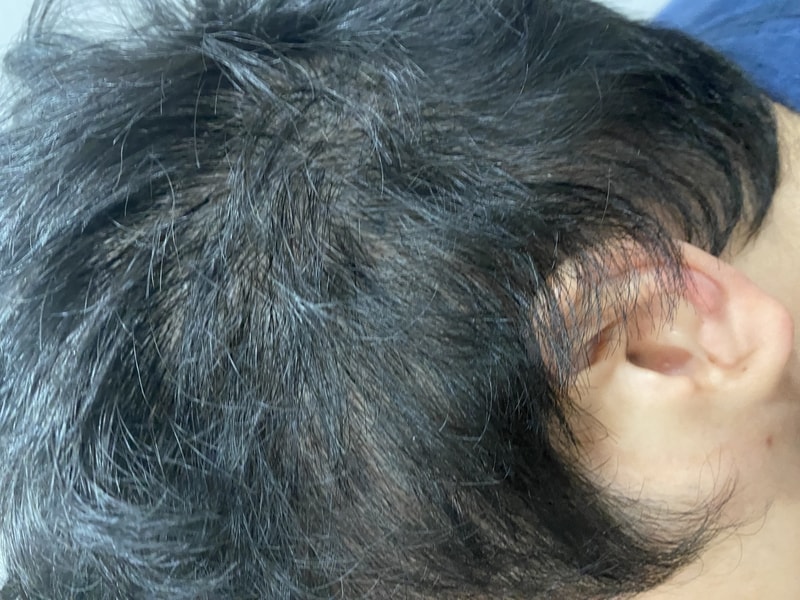 두피문신전0.jpg