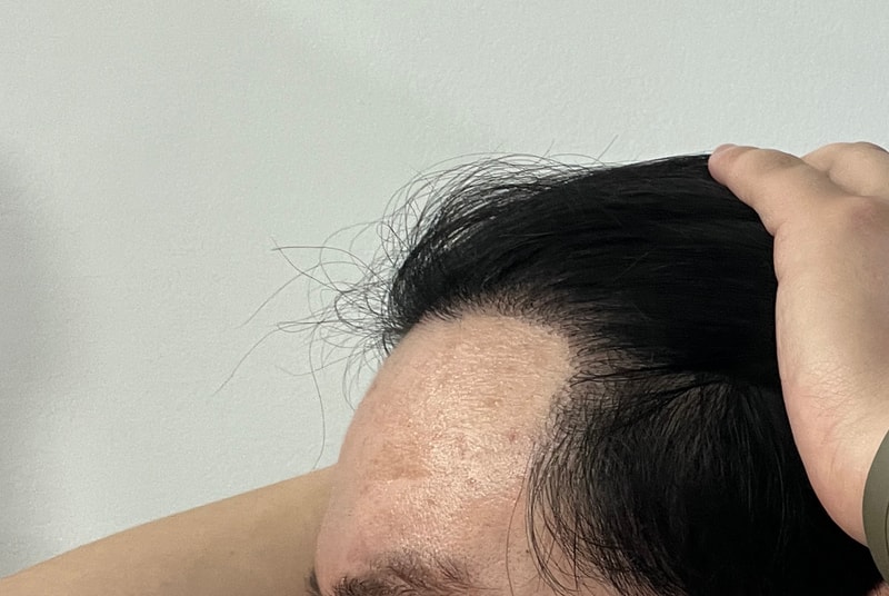 1년경과 2.JPG