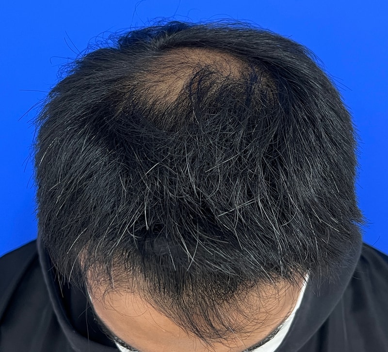 수술전 2.jpg