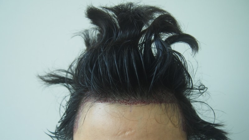 수술직후1.jpg