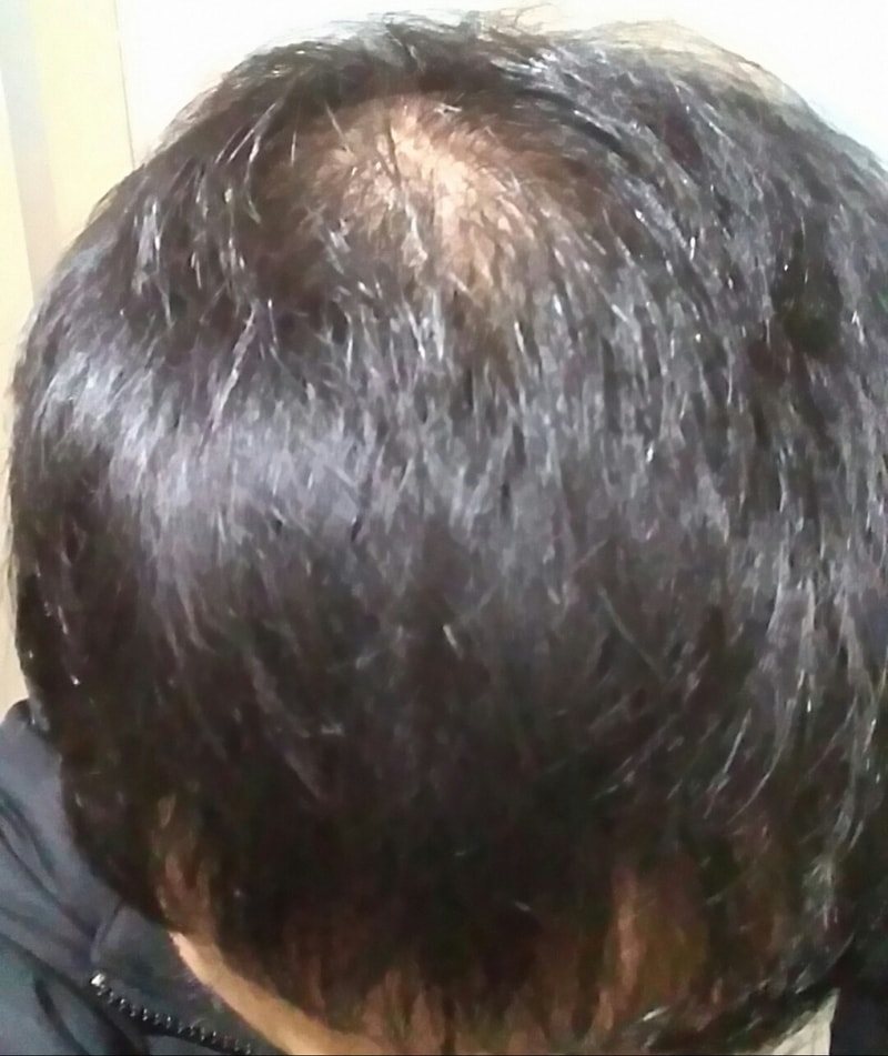 모재성 12개월차 후기
