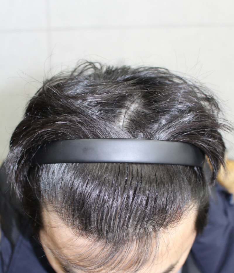 사회복사회복제목 없음.png