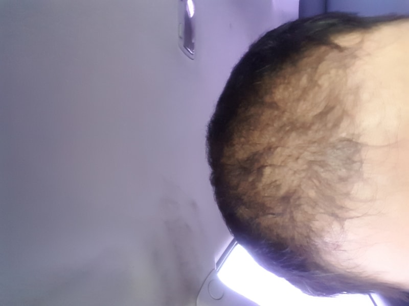 이식한지 삼개월차입니다
