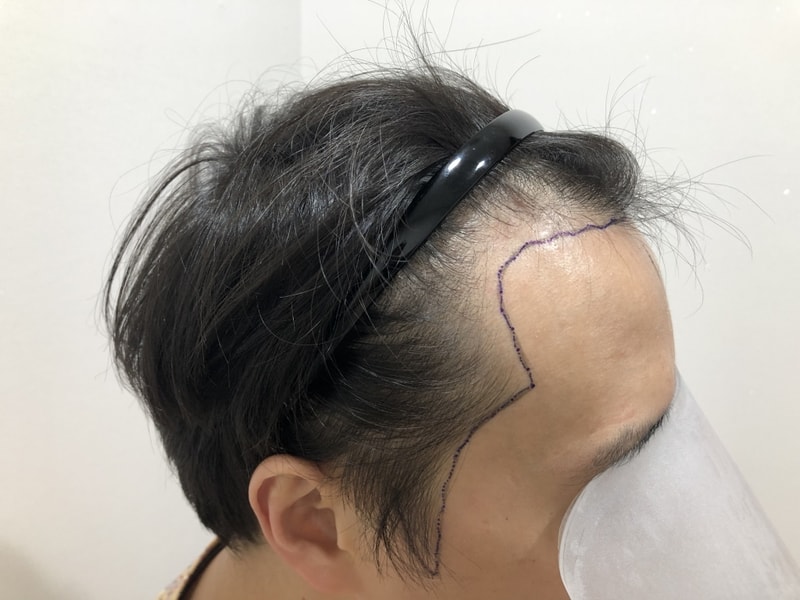 913564A1-6E01-4D6E-916B-9C9A22C9C8E7.jpeg