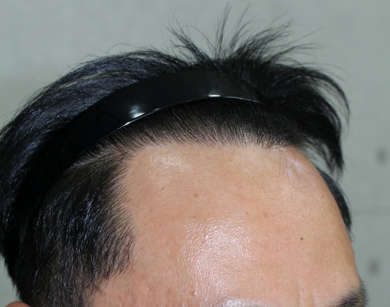 8달좌측.jpg