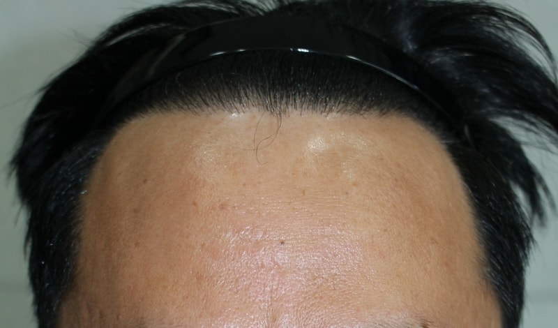 8달정면.jpg