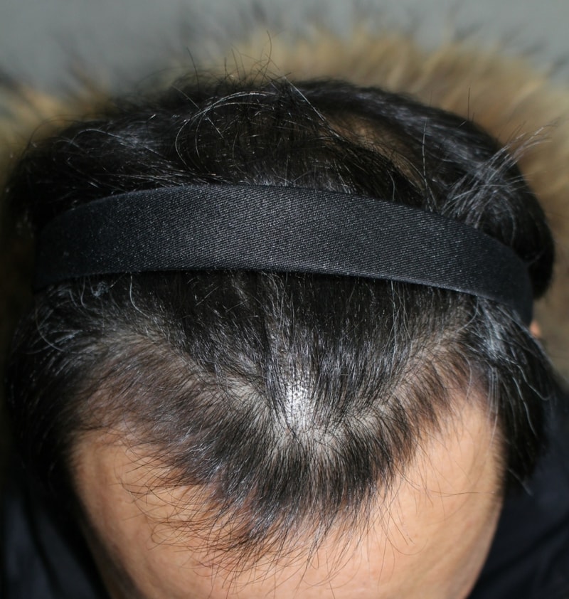 4달 정면.jpg