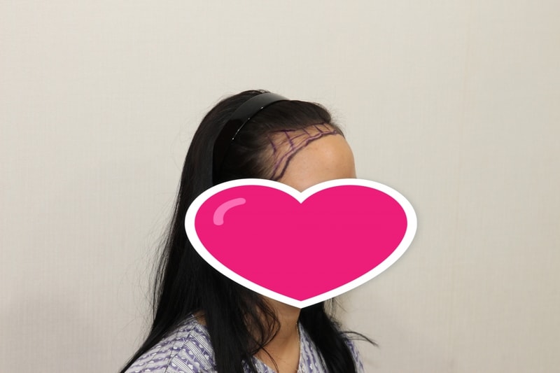 FD382A32-48AE-4C29-9DED-D70A10011B50.jpeg
