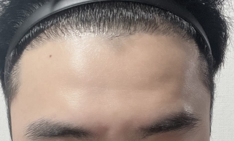 꾸미기김민준_정면_후.jpg