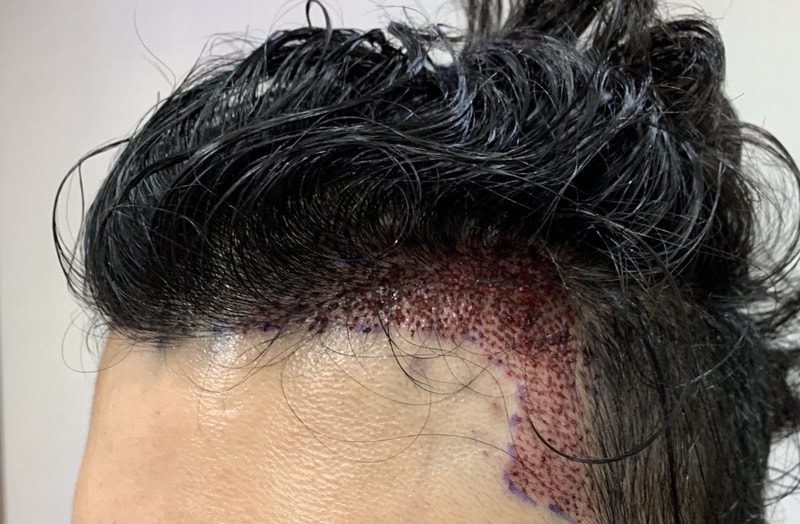 Post your review on the day of surgery and three months after