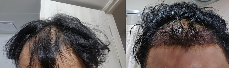 비포ㅔ프터.jpg