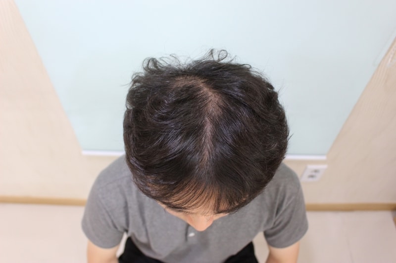 수술후3개월  (5).JPG
