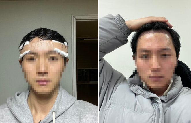 스크린샷 2025-03-24 202156.png