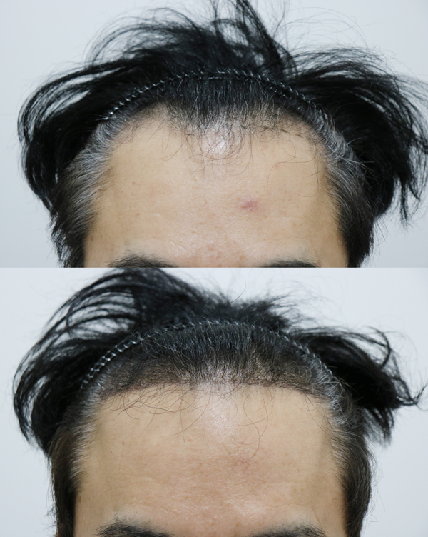 약이주전 5666모 심었습니다
