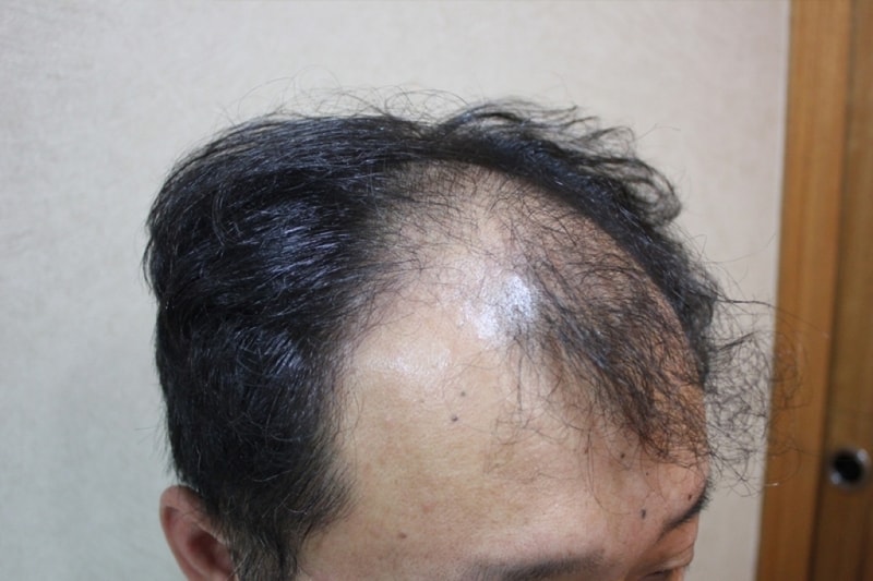 수술전 (2).JPG