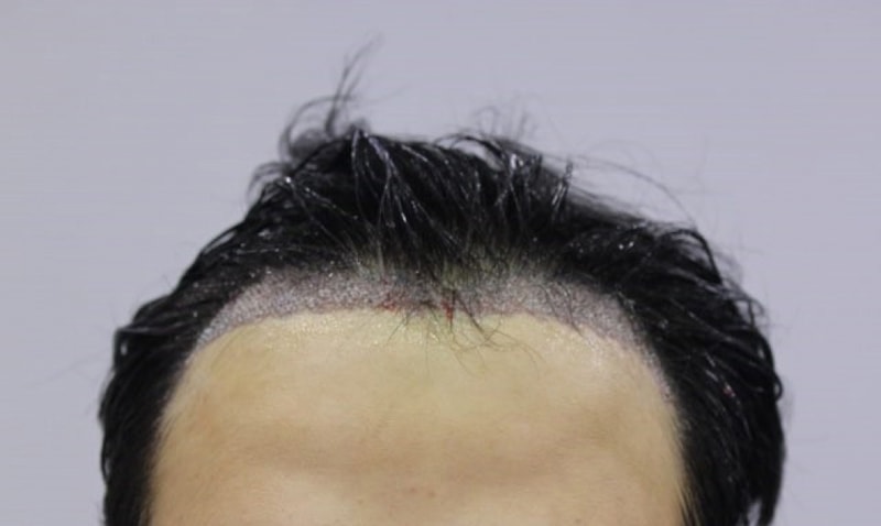 수술후2.jpg