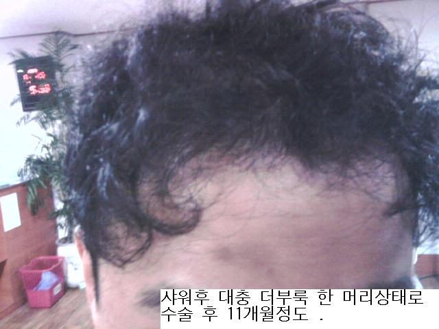 1년 더부룩.jpg