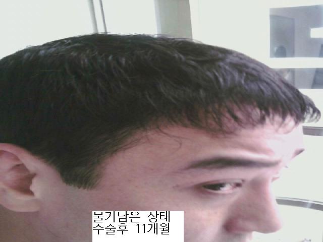 1년 물기.jpg