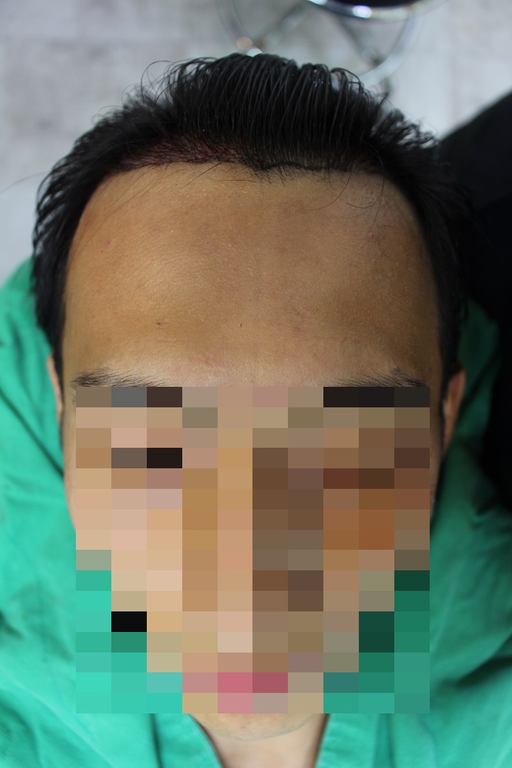 수술직후_3.JPG