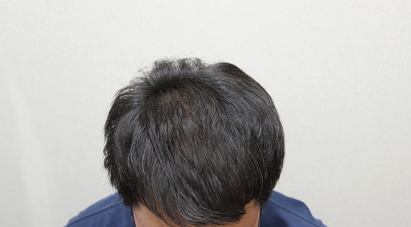 5. 1년 경과 IMG_4738.JPG