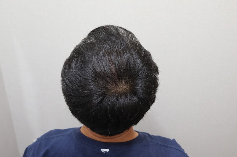 7. 1년 경과 IMG_4773.JPG
