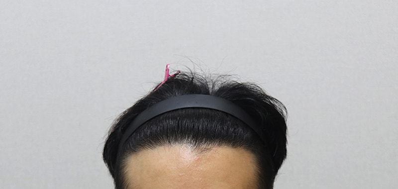 7. 정면 숙이고 IMG_2187.jpg