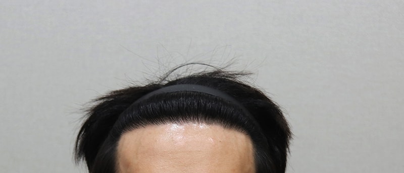 5. 1년 경과 IMG_4678.JPG
