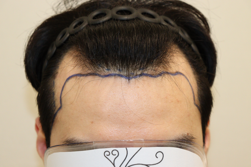 FD0A56EA-1F25-4990-8355-4D1B9EF304A6.png