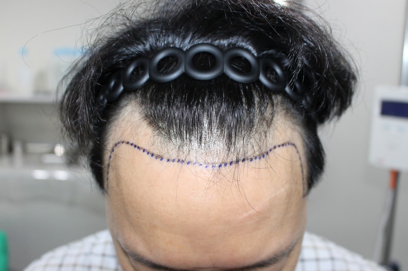 モダオール医院のヤン·ユグン院長をお勧めします。