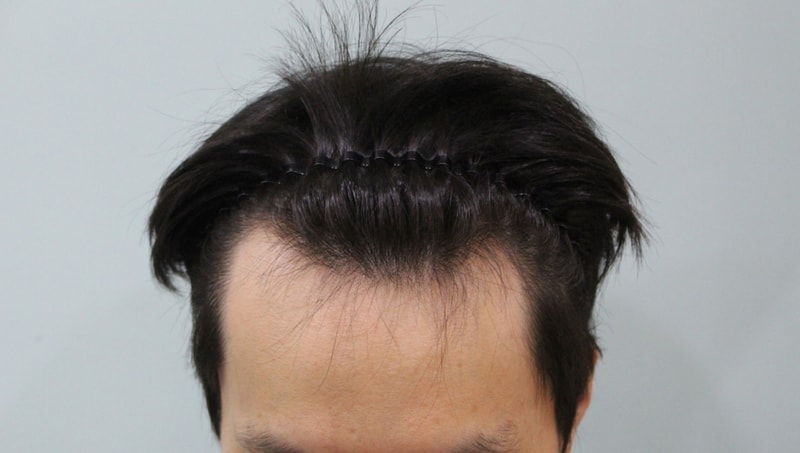 수술전.jpg