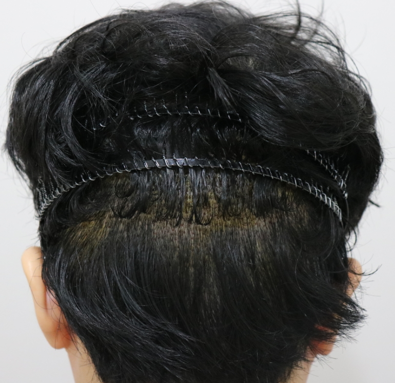 수술사진 (5).jpg
