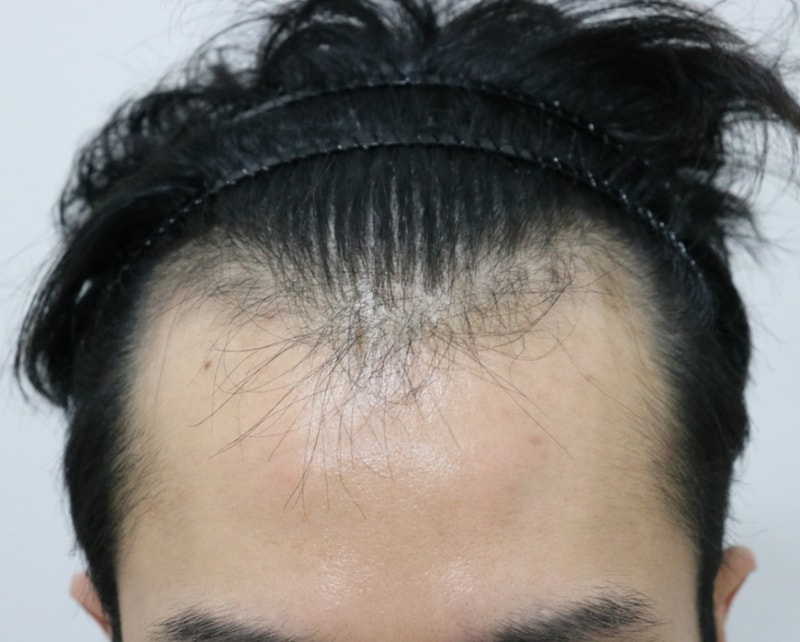 수술사진.jpg