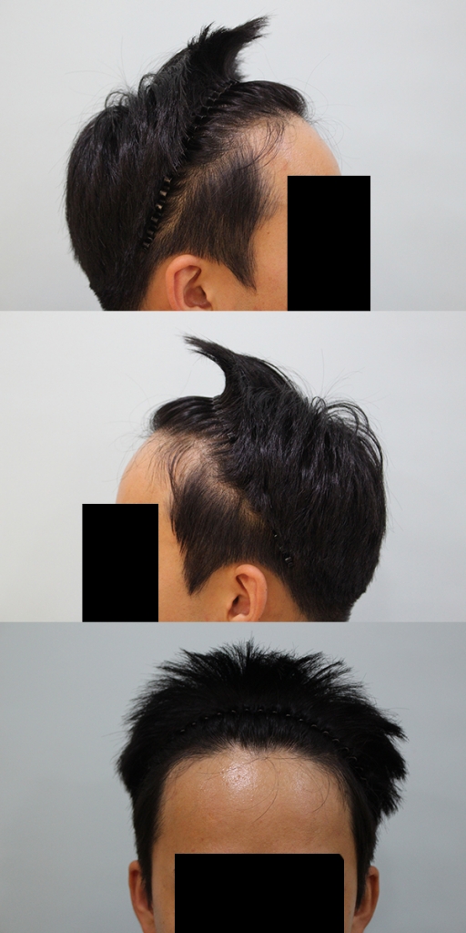 수술전.jpg