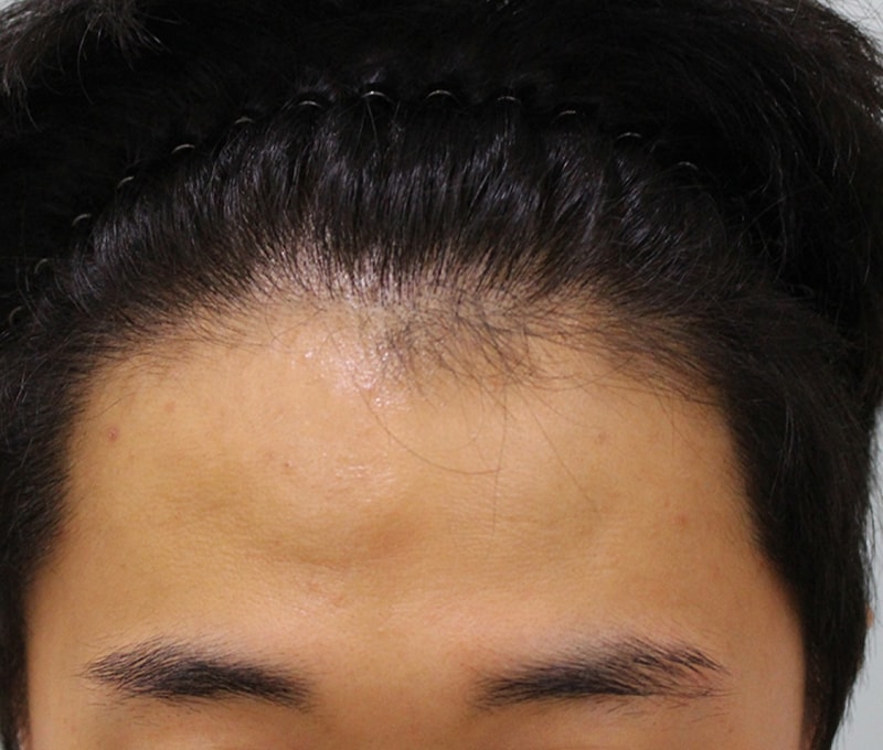 수술전 (2).JPG