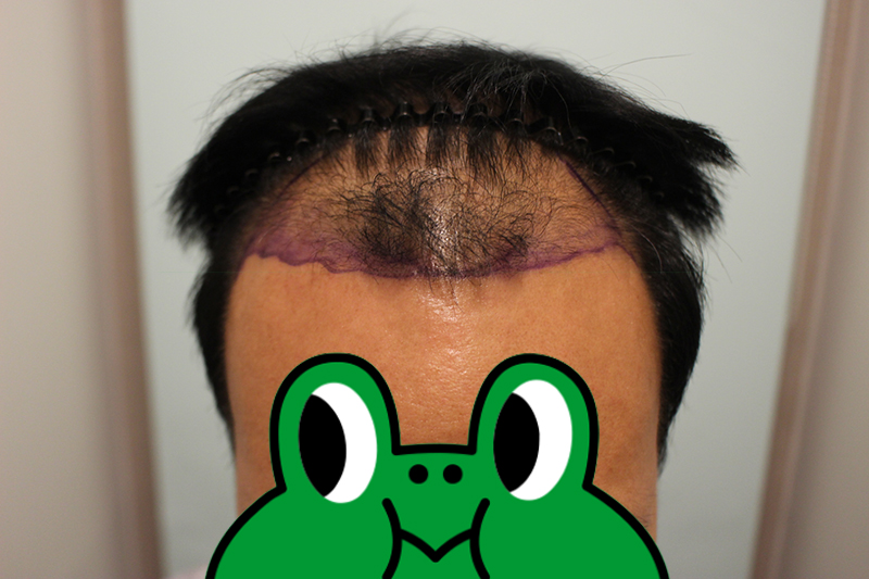 이전 1.jpg