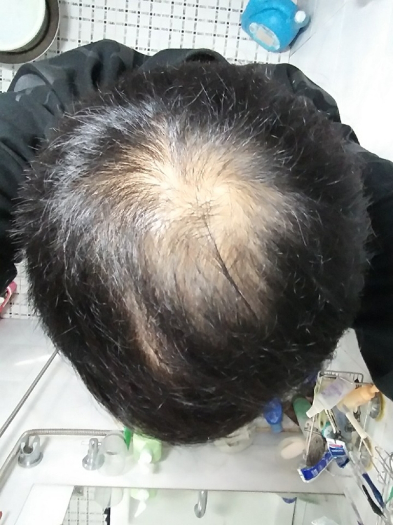 전 (1).jpg