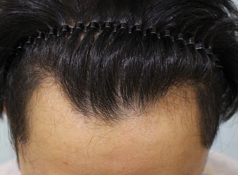 수술전 (11).JPG