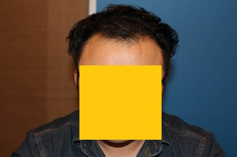 수술전.jpg