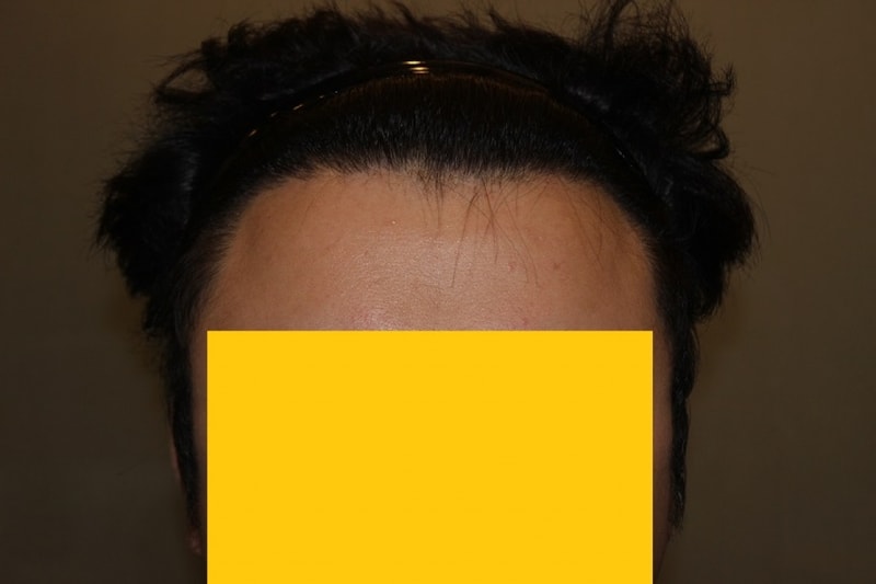 수술후.jpg