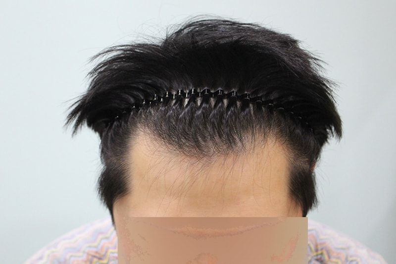 수술전 (7).JPG