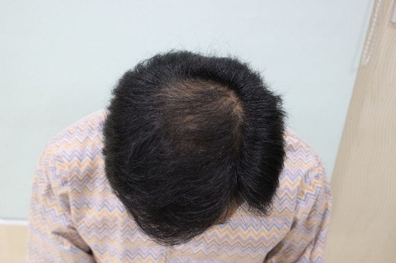 수술전 (5).JPG