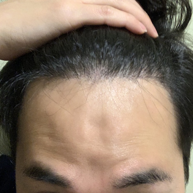 크기변환_6개월3.jpg
