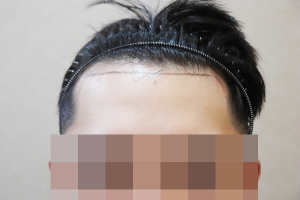 101.jpg